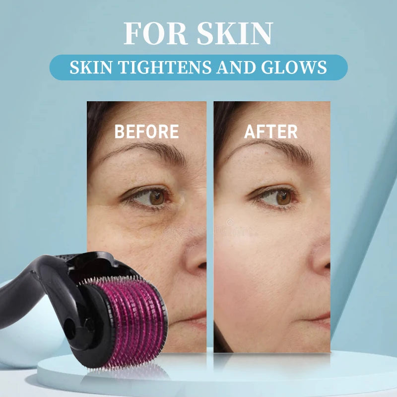 Professional Titanium Derma Roller 540 Needles
