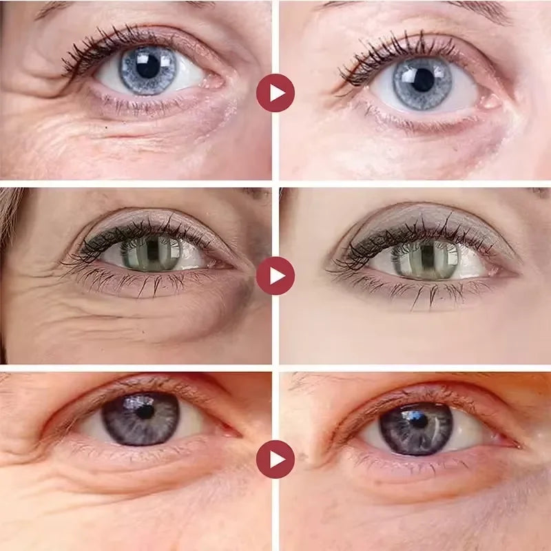 EyeLift Instant Cream